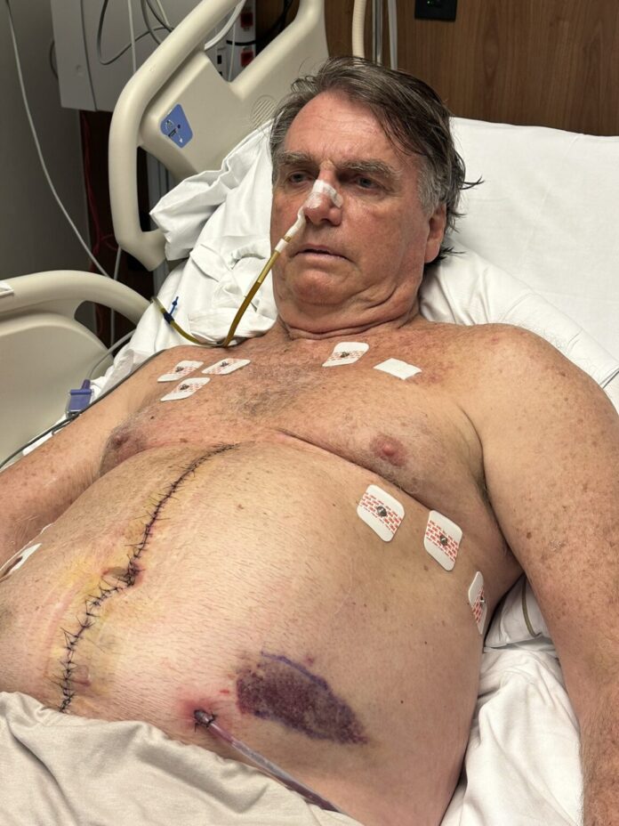Bolsonaro segue na UTI após cirurgia