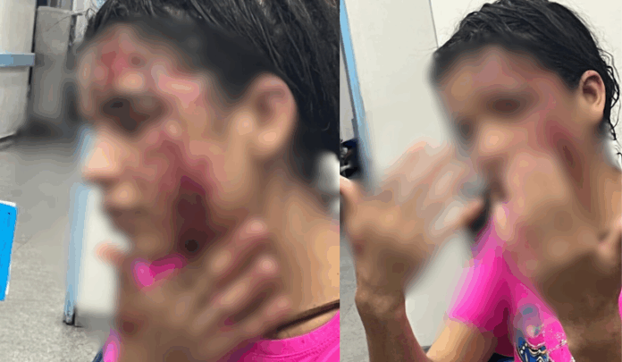 Jovem denuncia espancamento após festa em adega de Manaus
